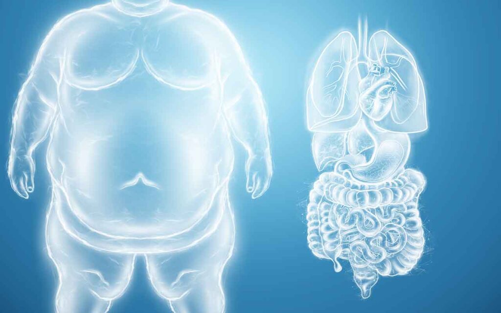 chirurgie bariatrique choisir pour atteindre votre objectif de poids